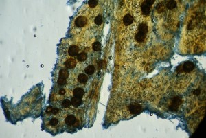 Mychosphaerella 3