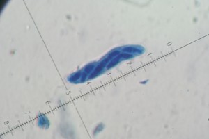 Mychosphaerella 4